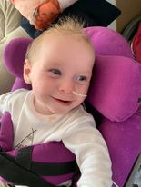 Baby’s plight inspires fundraiser