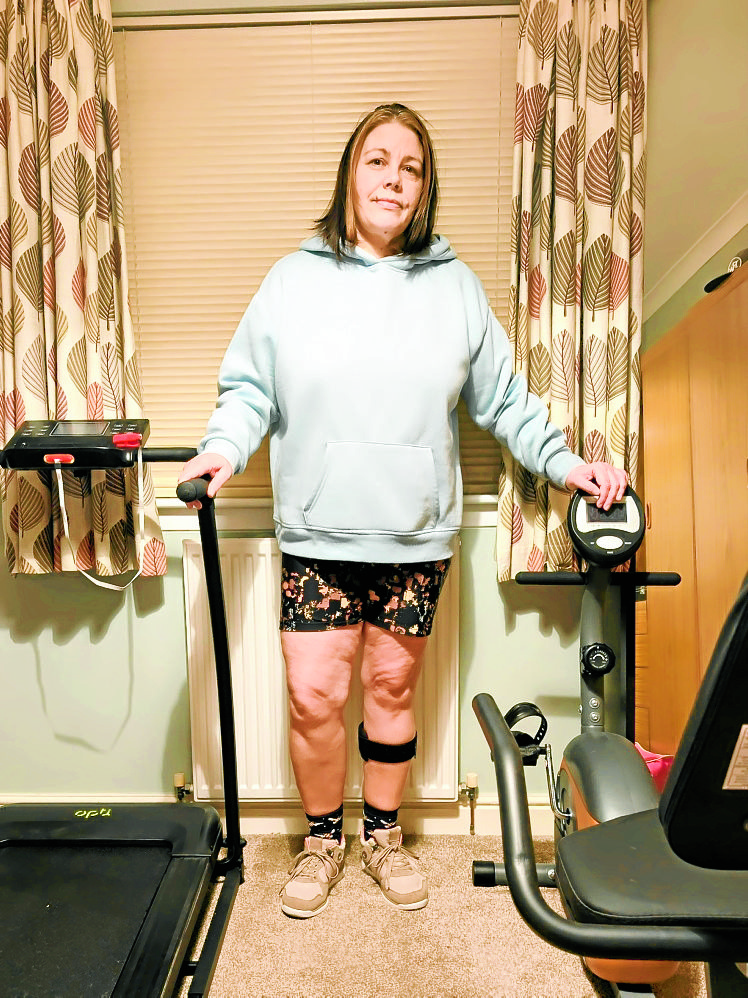 Life after a stroke